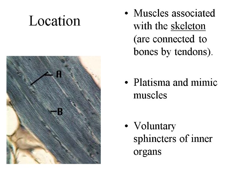 Location Muscles associated with the skeleton (are connected to bones by tendons). Location Muscles associated with the skeleton (are connected to bones by tendons).